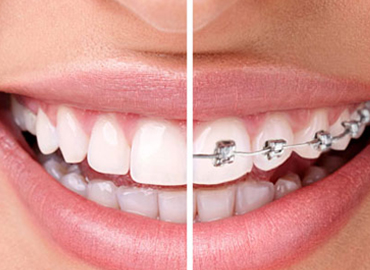 cosmetic-dentistry