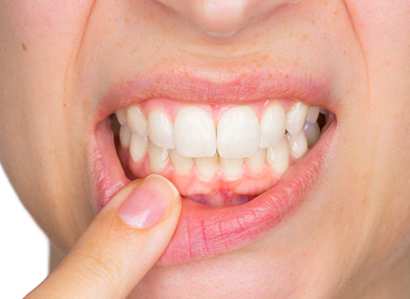 cosmetic-dentistry